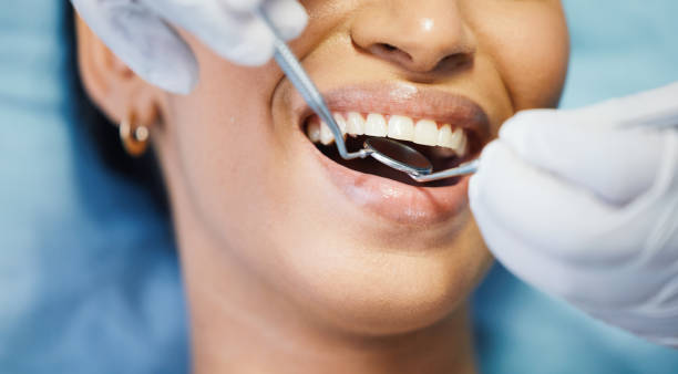 Best Dental Abscess Treatment in Boiling Springs, NC